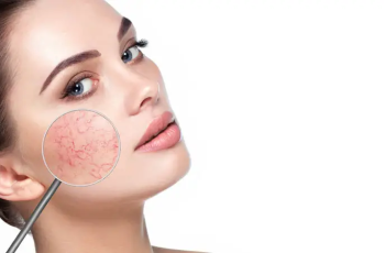 Managing Sensitive Skin in Different Skin Types