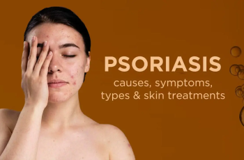Psoriasis: What It Is, Symptoms, Causes, Types & Treatment Psoriasis: What It Is, Symptoms, Causes, Types & Treatment