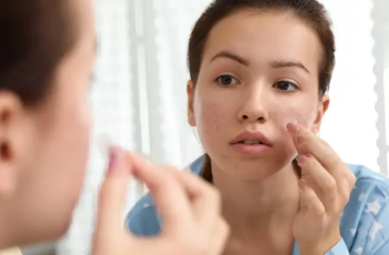 How Do Pimple Patches Work? Whether They’re Worth Adding to Your Routine How Do Pimple Patches Work? Whether They’re Worth Adding to Your Routine