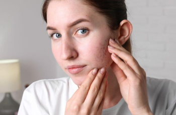 Sulfur in Skincare: Everything You Need to Know