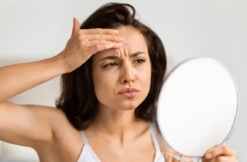 Dioscorea villosa in Topical Skincare: Hormonal Implications and Dermatologic Uses Dioscorea villosa in Topical Skincare: Hormonal Implications and Dermatologic Uses