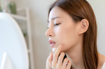 Say Goodbye to Breakouts: Non-Comedogenic Skincare That Works