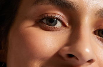 Effective Treatments for Dark Circles: Causes and Solutions Explained Effective Treatments for Dark Circles: Causes and Solutions Explained