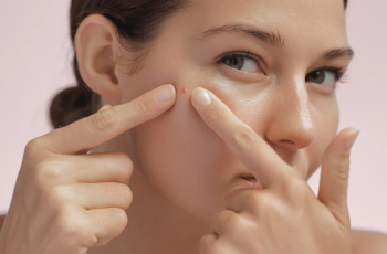 Busting Acne Myths: What Really Works for Clear Skin Busting Acne Myths: What Really Works for Clear Skin