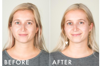 What Happens to Your Skin When You Quit Alcohol