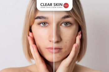 Even Out Your Skin Tone: Expert Tips for a Glowing, Balanced Complexion