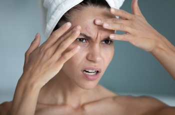 Beyond the Surface: When Skin Issues Trigger Emotional Pain Beyond the Surface: When Skin Issues Trigger Emotional Pain