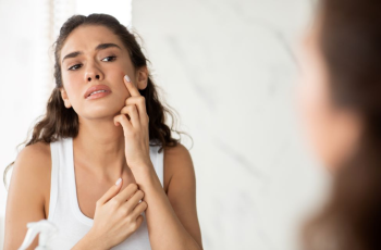 How to Use Azelaic Acid and BHA in Skincare How to Use Azelaic Acid and BHA in Skincare