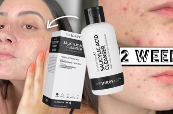 Does Salicylic Acid Clear Acne? Here’s What Experts Say