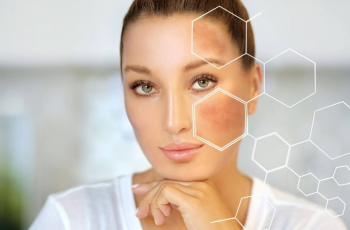 Effective Skincare and Lifestyle Tips to Fade PIH Naturally