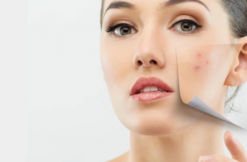 Understanding Sebum: Skin Oil’s Role in Skincare Science Understanding Sebum: Skin Oil’s Role in Skincare Science